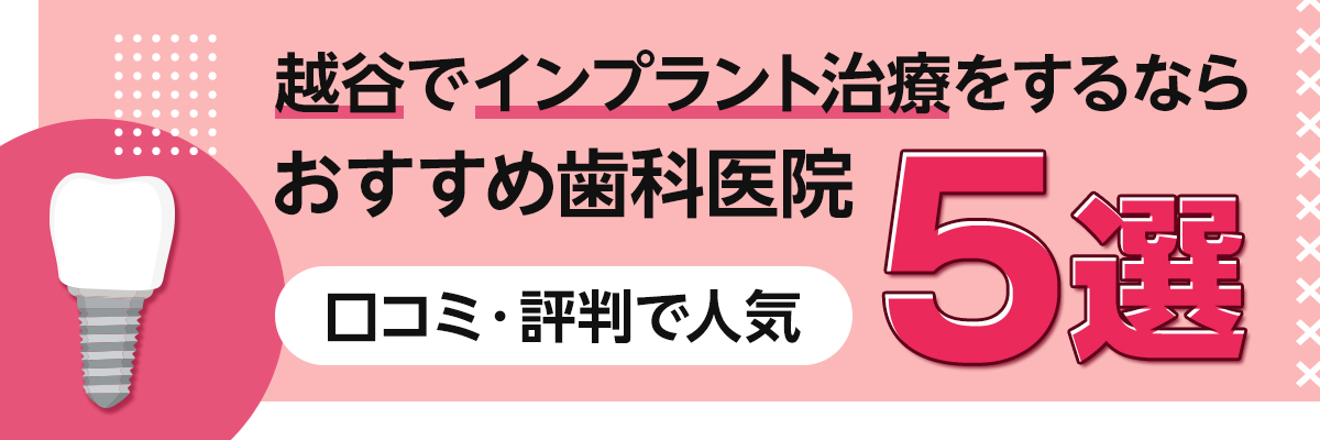 越谷でインプラント治療をするならおすすめ歯科医院5選｜口コミ・評判で人気